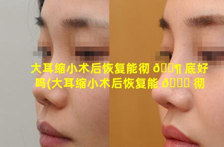 大耳缩小术后恢复能彻 🐶 底好吗(大耳缩小术后恢复能 🐋 彻底好吗图片)